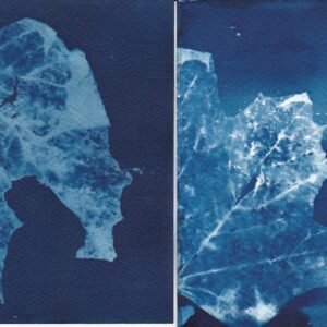 Radiographie